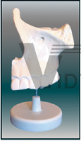 The expansion model of maxilla